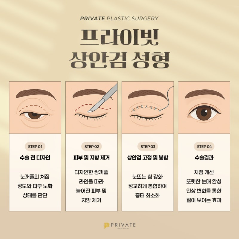 상안검수술후기 확인은 프라이빗성형외과 사진 4