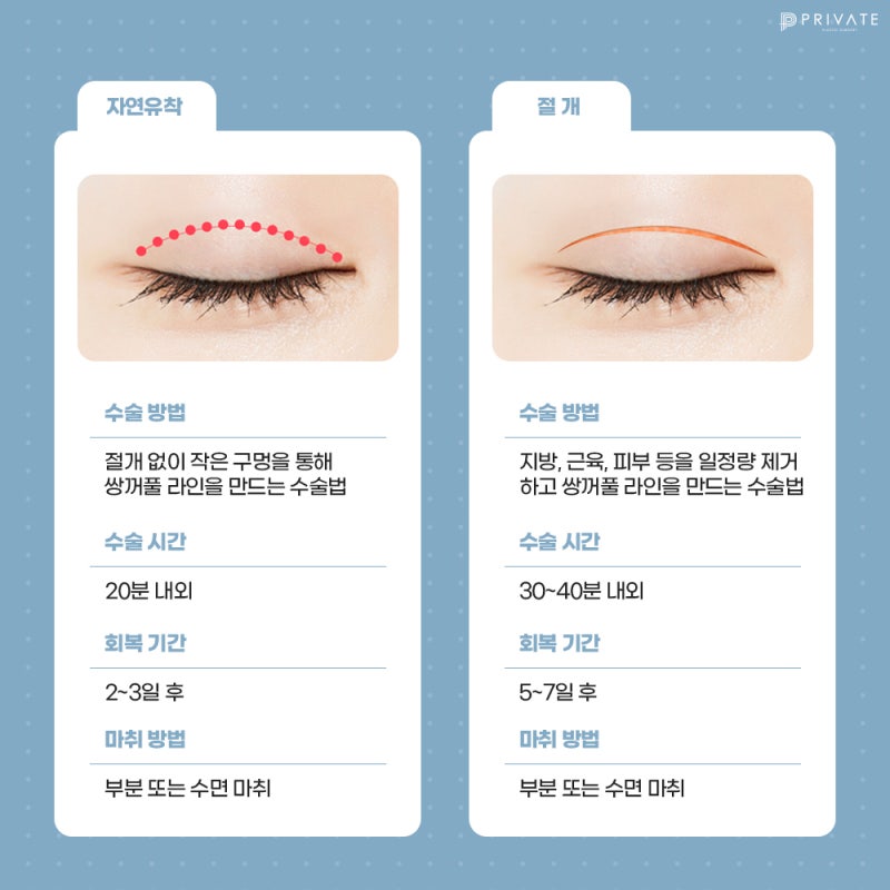 쌍수 잘하는 성형외과, 프라이빗성형외과 사진 5