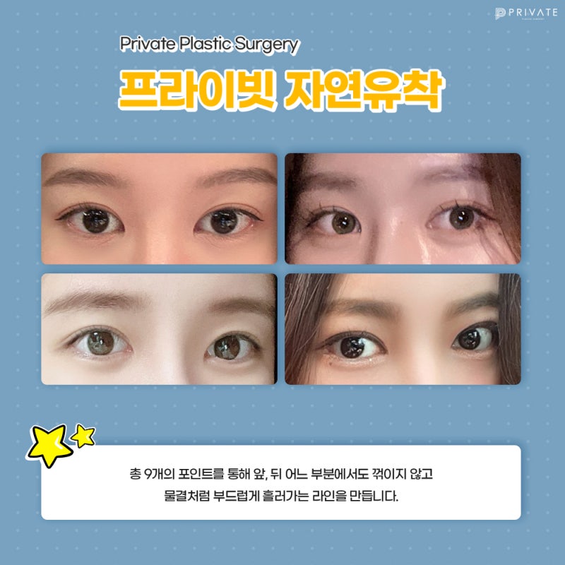 쌍수 잘하는 성형외과, 프라이빗성형외과