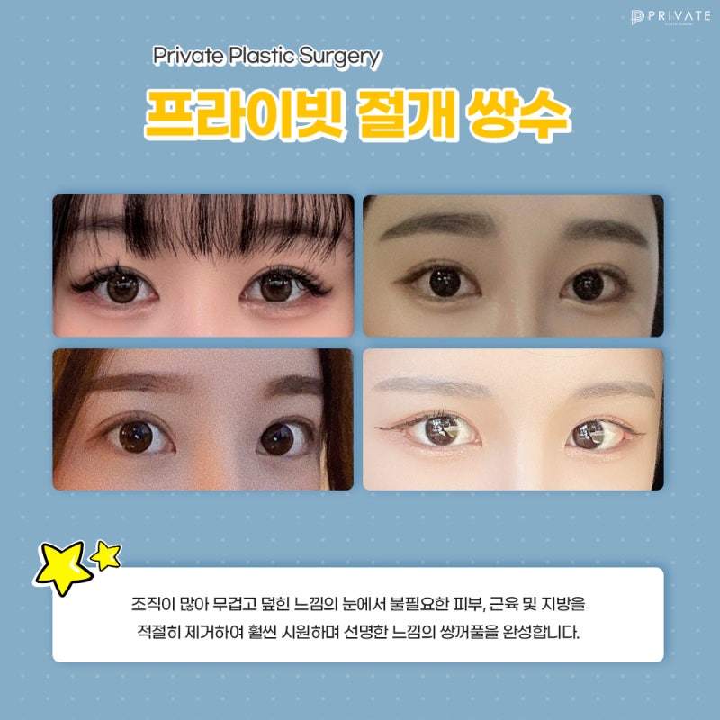 쌍수 잘하는 성형외과, 프라이빗성형외과 사진 4