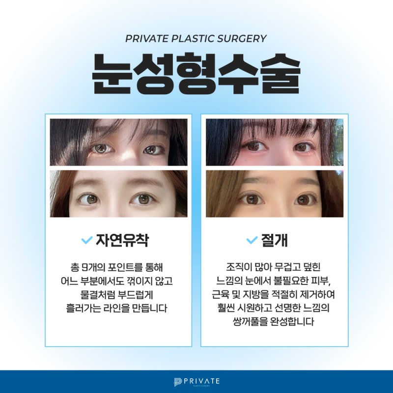 쌍수자연유착 신사 프라이빗성형외과에서 알아보자 사진 4