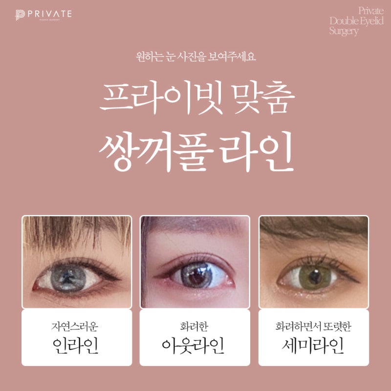 신사 프라이빗성형외과에서 쌍수 절개 후기 확인하기 사진 4
