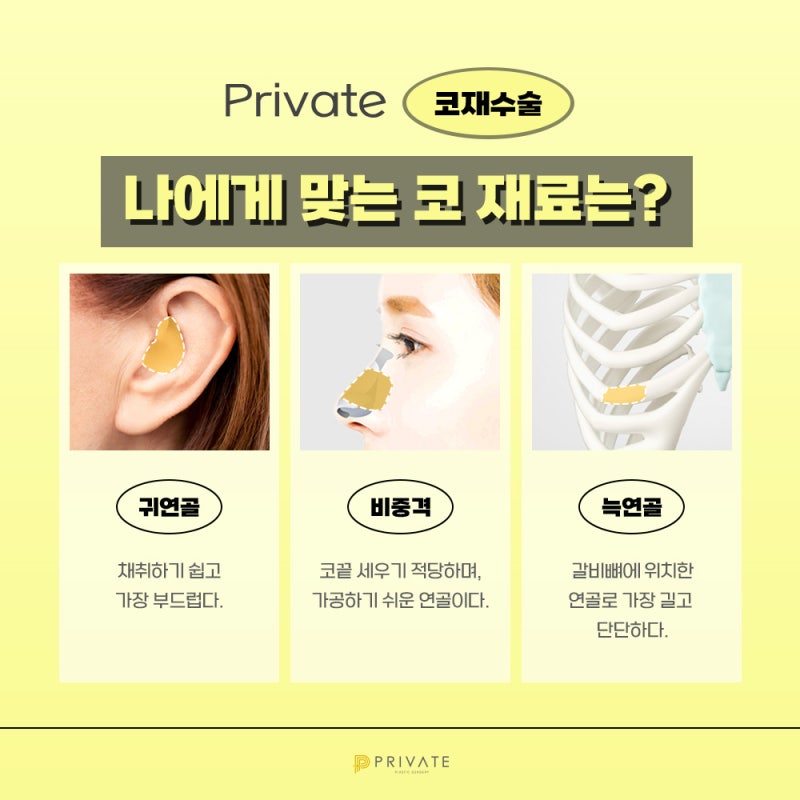 코재수술후기는 프라이빗성형외과