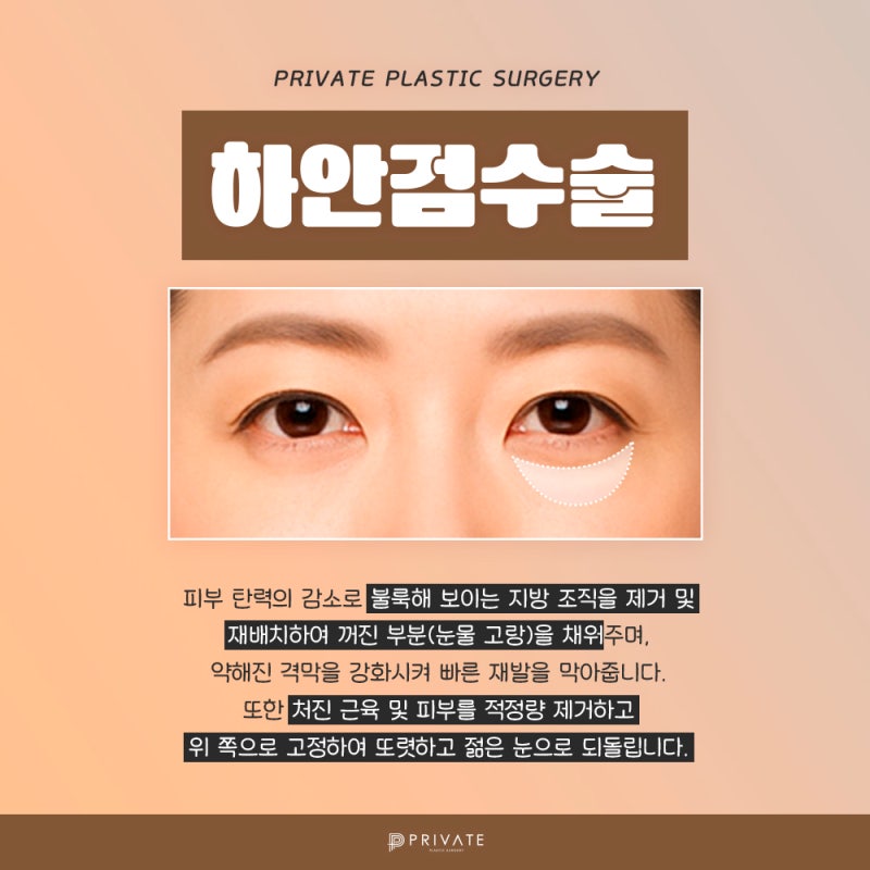 눈밑하안검수술은 신사 프라이빗성형외과