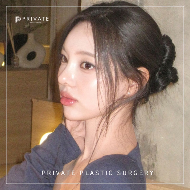 프라이빗성형외과 성형모델모집 관심있다면 여기 사진 3