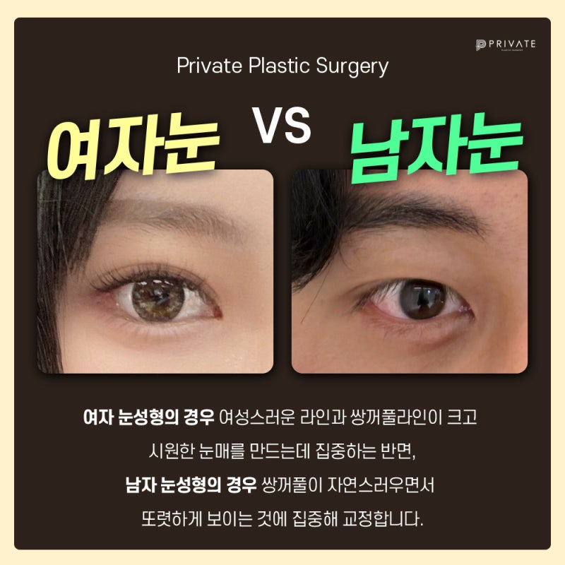 남자 눈매교정쌍수 잘하는 곳은 프라이빗성형외과 사진 4