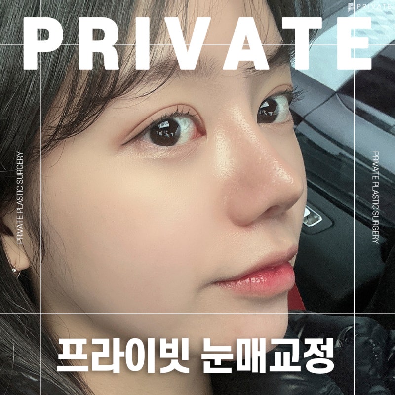 눈매교정수술전후가 좋은 프라이빗성형외과 사진 2