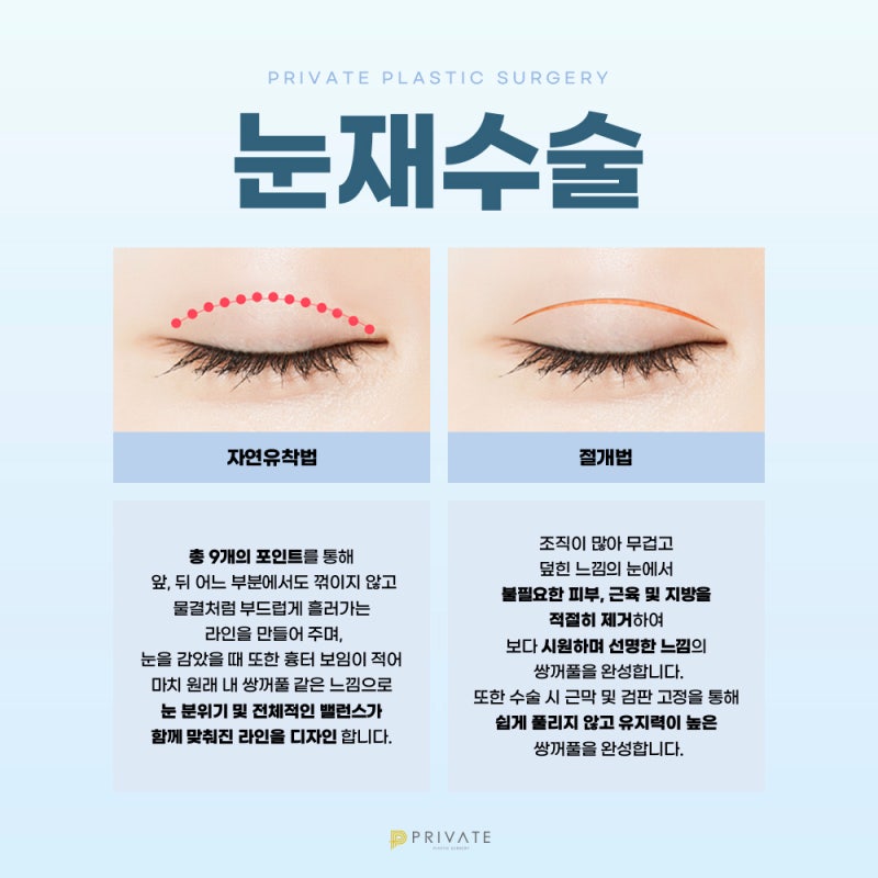 눈재수술잘하는곳 신사 프라이빗성형외과 사진 4