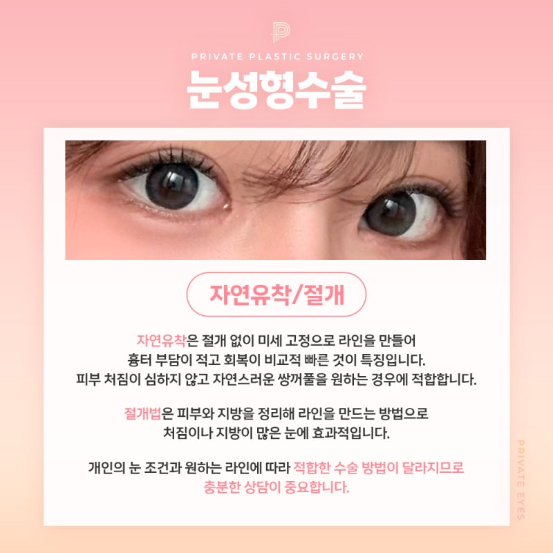 쌍꺼풀 수술 후기가 좋은 신사 프라이빗성형외과 사진 4