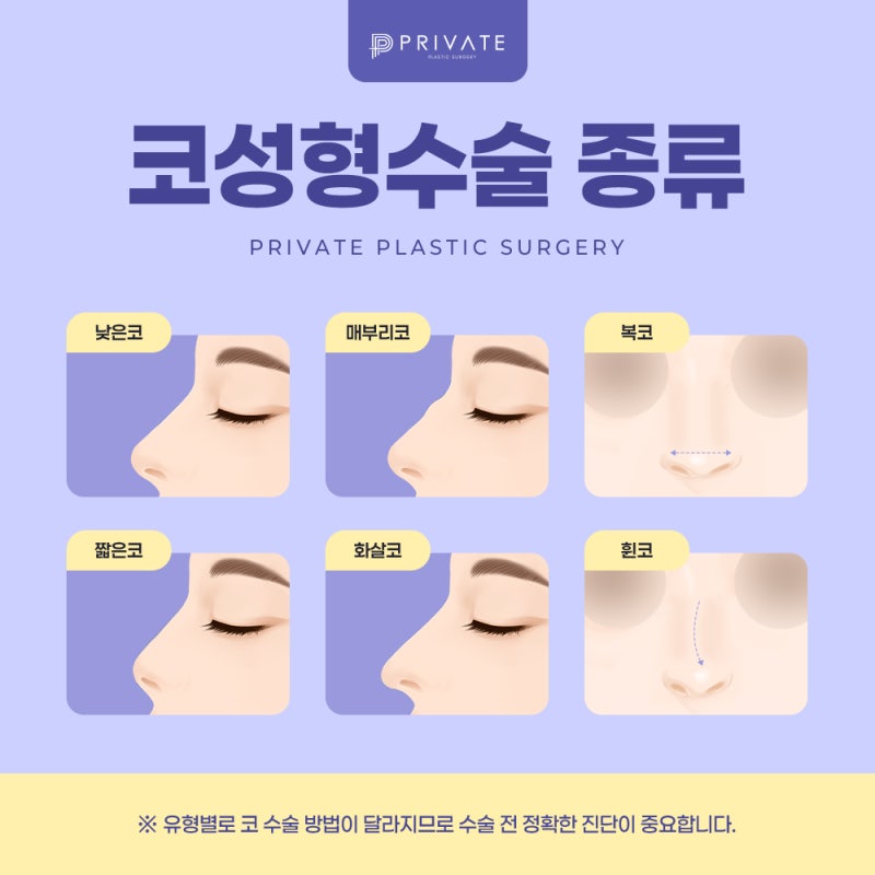 프라이빗 성형외과 코수술후기 좋은 병원 사진 4