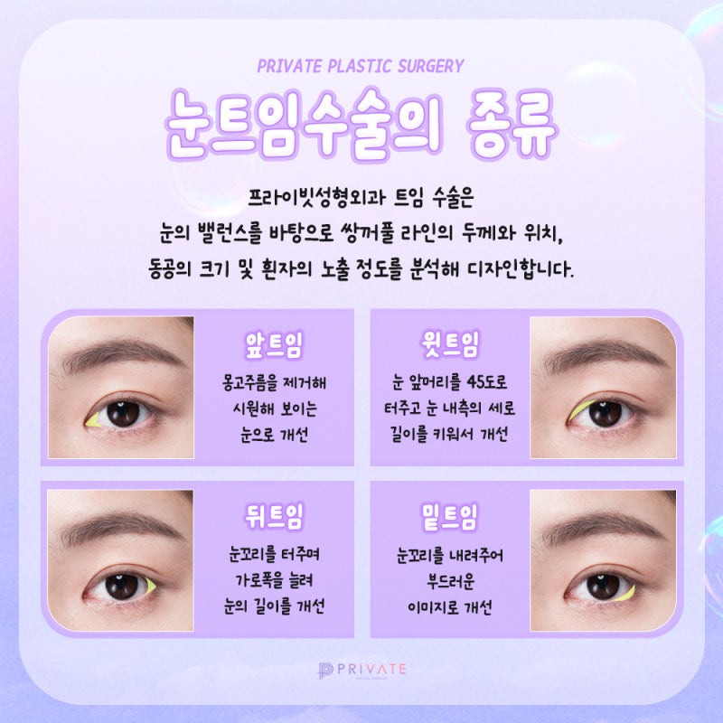 프라이빗 성형외과 뒤트임 알아보기